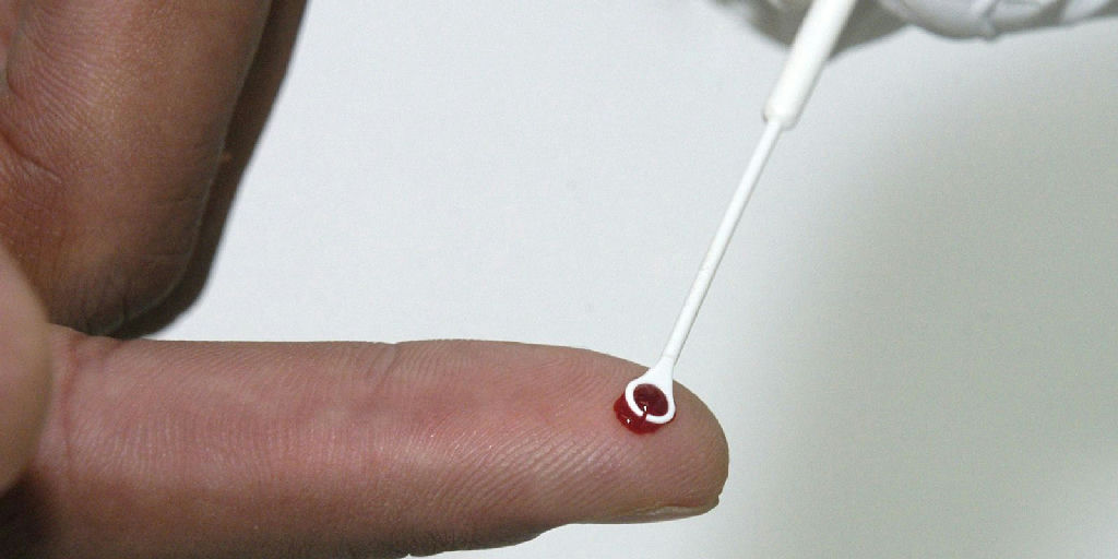 Fiji decreta emergência nacional diante do avanço acelerado de casos de HIV