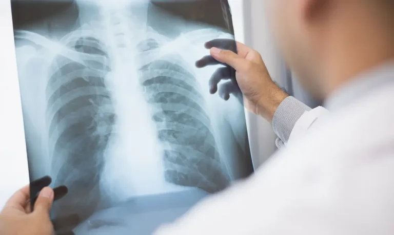 Anvisa aprova novos medicamentos para tratamento de câncer de pulmão e mama