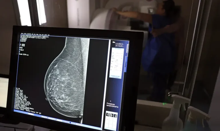 Entidades criam cartilha para barrar recusa de mamografia digital por operadoras